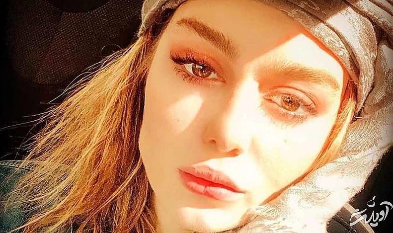  عکس - سحر قریشی خودش را زشت کرد - بلای ناگوار عمل زیبایی بر سر خانم بازیگر جذاب !